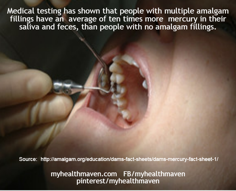 People with Amalgam Fillings Have Higher Mercury Levels