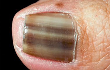 Dark-stripes-nails